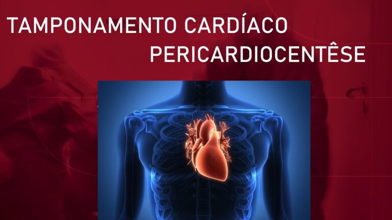 Entenda o Tamponamento Cardíaco: Causas e Tratamentos