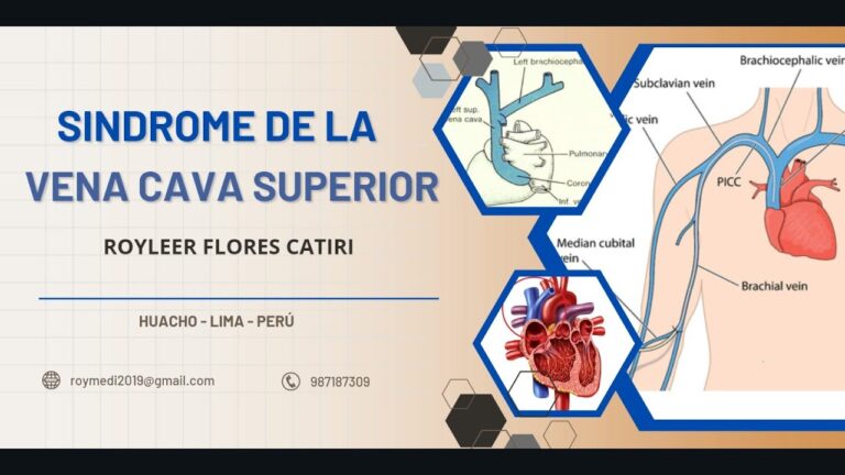 Sintomas de Veia Cava Inferior Dilatada: O Que Voc&ecirc; Precisa Saber