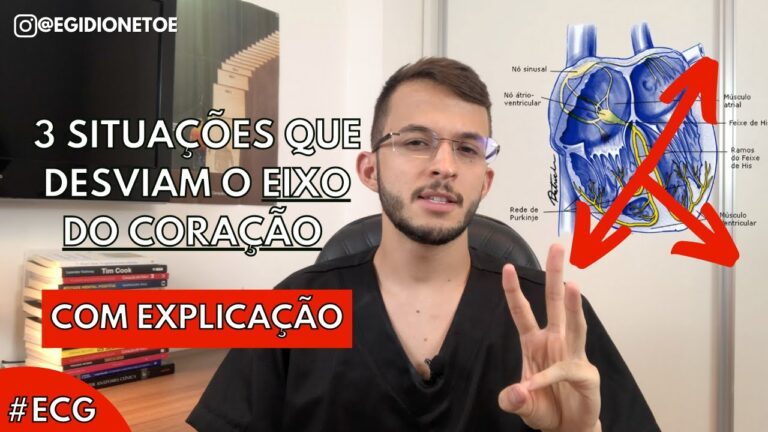 Desvio do eixo para esquerda no ECG: o que você precisa saber