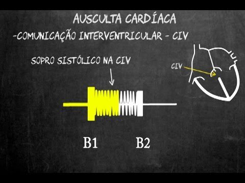 O que é o Sopro Civil e como ele impacta a sociedade brasileira