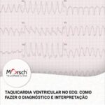 Endocrinologista SBC: Cuidados e Tratamentos Essenciais