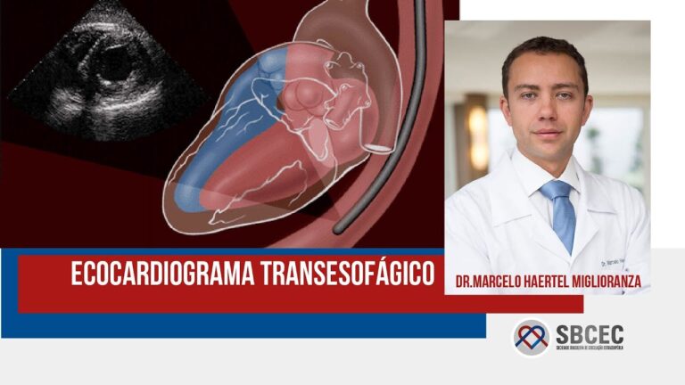 Preço do Eco Transesofágico: Guia Completo