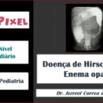Ginecomastia em Mulheres: Causas, Sintomas e Tratamentos