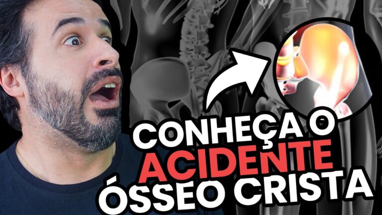 Localização da Crista Ilíaca: Importância e Anatomia