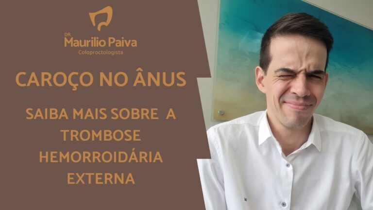 Risco de Trombo no Ânus: Causas e Tratamentos