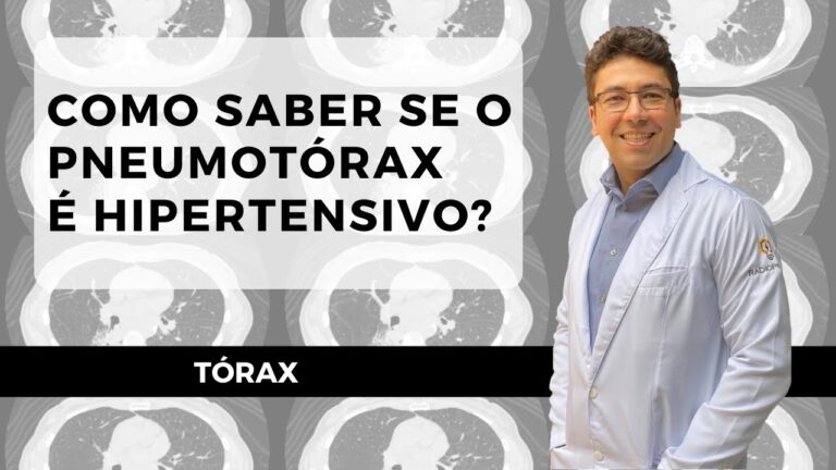 Pneumotórax Simples: Causas, Sintomas e Tratamentos