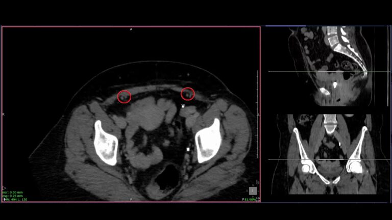 Anatomia Abdominal Feminina: Guia Completo e Visual