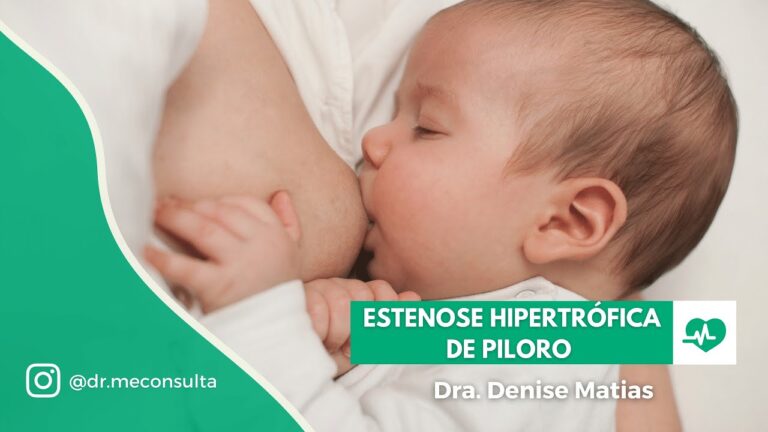 Estenose Hipertrofica de Piloro: Causas, Sintomas e Tratamentos