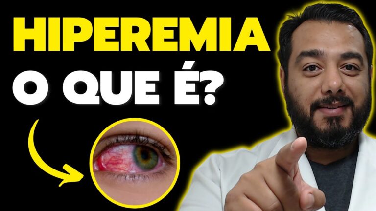 Guia Completo sobre Eritema Conjuntival: Causas, Sintomas e Tratamentos