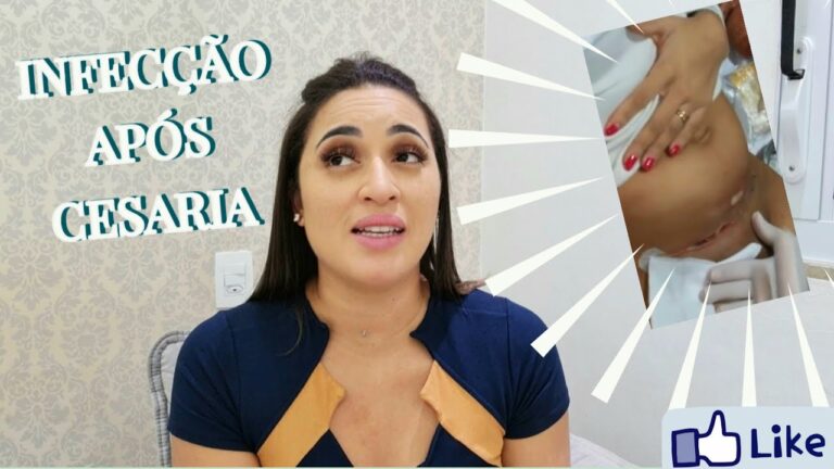Complicações de Cesárea: Prevenção e Tratamento de Infecções
