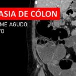 Calculadora de Escore de Lee: Otimize Seus Resultados