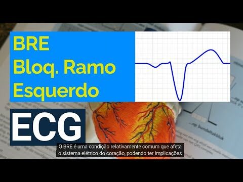 Desvendando o Bloqueio Bifascicular: Causas, Sintomas e Tratamentos