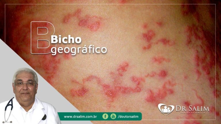 Fotos de Larva Migrans: Guia Completo