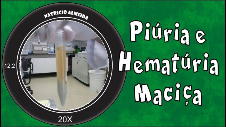 Entendendo a Piúria: Causas, Sintomas e Tratamento