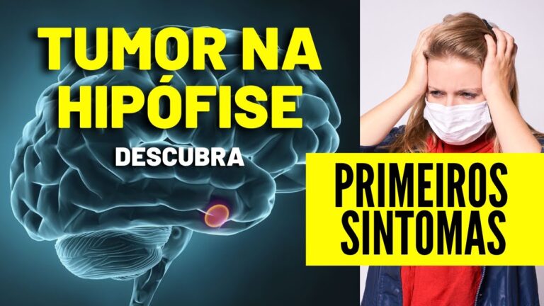 Compreens&atilde;o do c&acirc;ncer de hip&oacute;fise: causas, sintomas e tratamentos