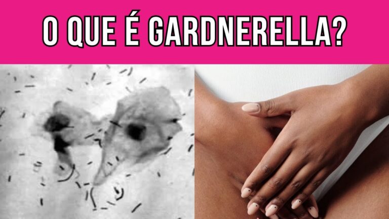 Guia Completo sobre Gardnerella Vaginalis | Actualizado mayo 2026
