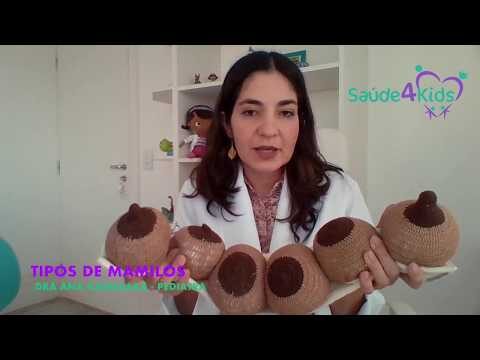 Guia Completo dos Tipos de Ar&eacute;ola