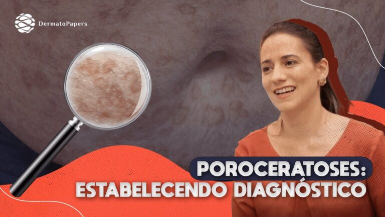 Poroceratose Actínica: Sintomas, Diagnóstico e Tratamento