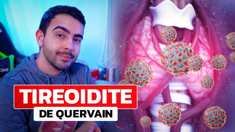 Diagnóstico e tratamento da tireoide subaguda