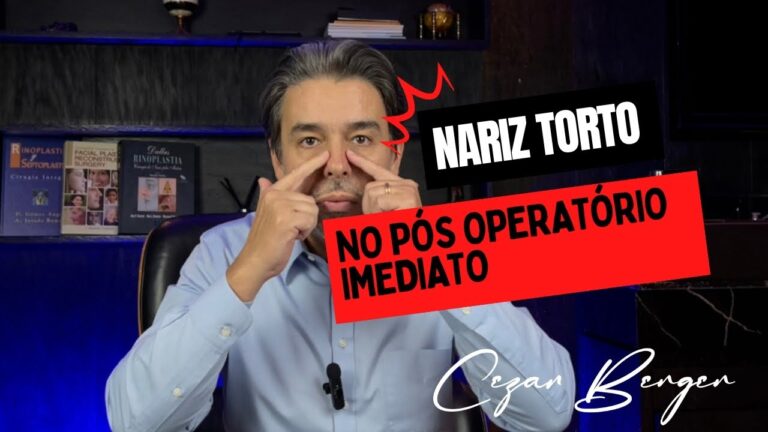 Correção de Nariz Torto: O que saber sobre rinoplastia