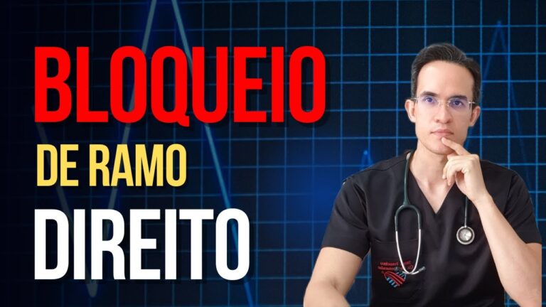 Entendendo o Bloqueio do Ramo Direito do Coração