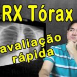 Calculadora de Escore de Lee: Otimize Seus Resultados