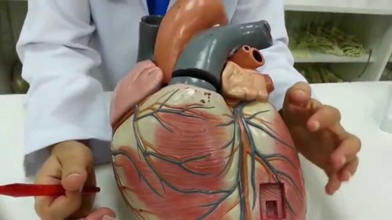 Obstrução da Artéria Circunflexa: Causas e Tratamentos