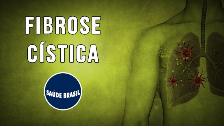 Oste&iacute;te Fibrosa C&iacute;stica: Causas, Sintomas e Tratamentos
