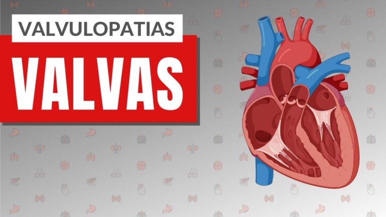 Valvulopatias: diagnóstico e tratamento