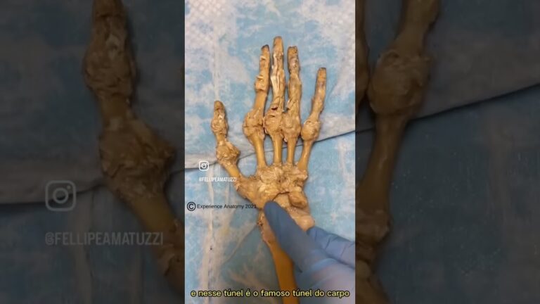 Entendendo o Ligamento Transverso do Carpo: Fun&ccedil;&atilde;o e Import&acirc;ncia
