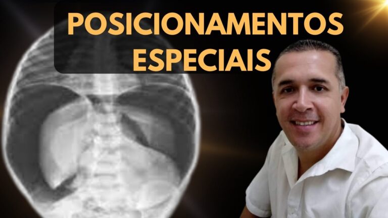 Raio X e Pneumoperitônio: Diagnóstico Eficiente em Emergências Abdominais