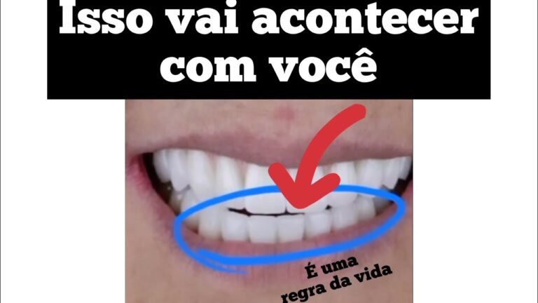 Transformação do Sorriso Baixo: Antes e Depois