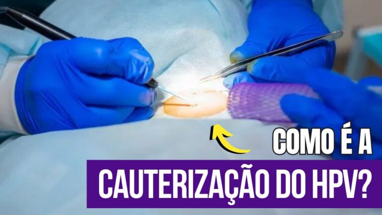 Cauterização de Verrugas: Entenda o Custo e Benefícios