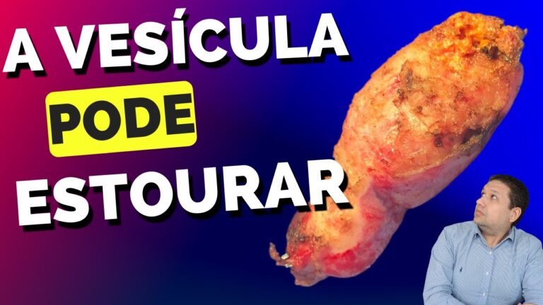 Entendendo a Vesícula Supurada: Causas, Sintomas e Tratamentos