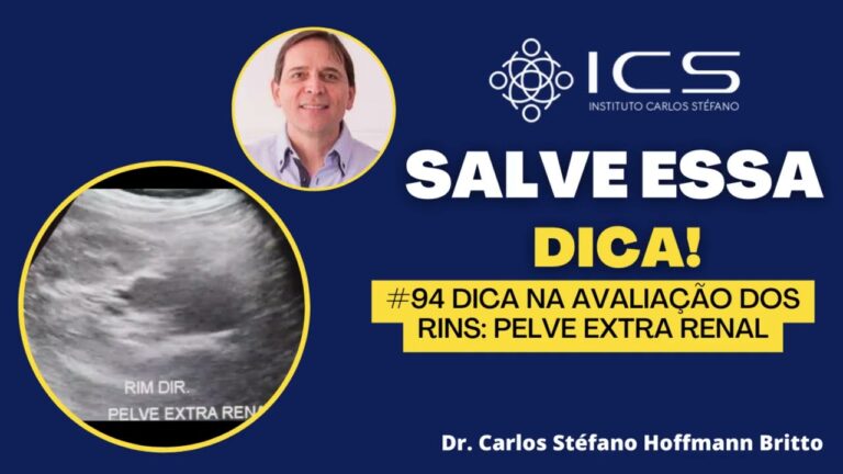 Sintomas da Pelve Extra Renal: Identificação e Implicações