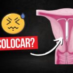 O papel do ginecologista especialista em candidíase: diagnóstico e tratamento