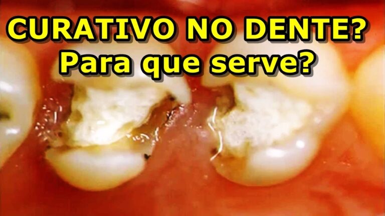 Avanços no Curativo Dentário: Soluções Inovadoras para Saúde Bucal