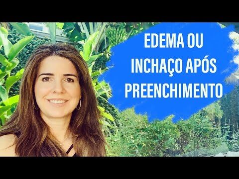 Por que o preenchimento de olheiras pode ficar inchado?
