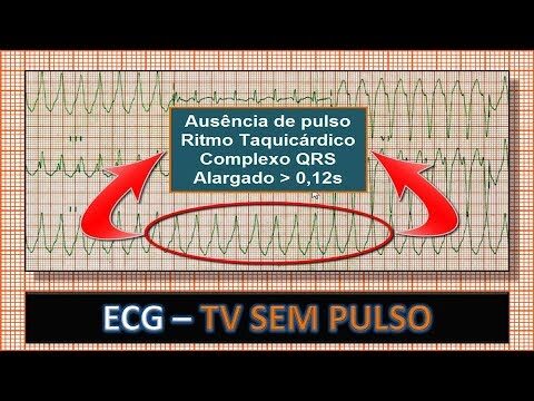 Soluções para TV Sem Pulso: Diagnóstico e Reparos Eficazes