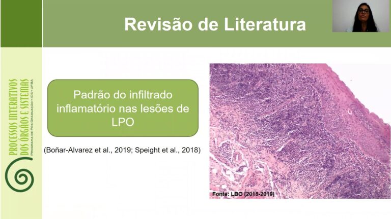 Entendendo o Infiltrado Linfocitário: Definição e Importância