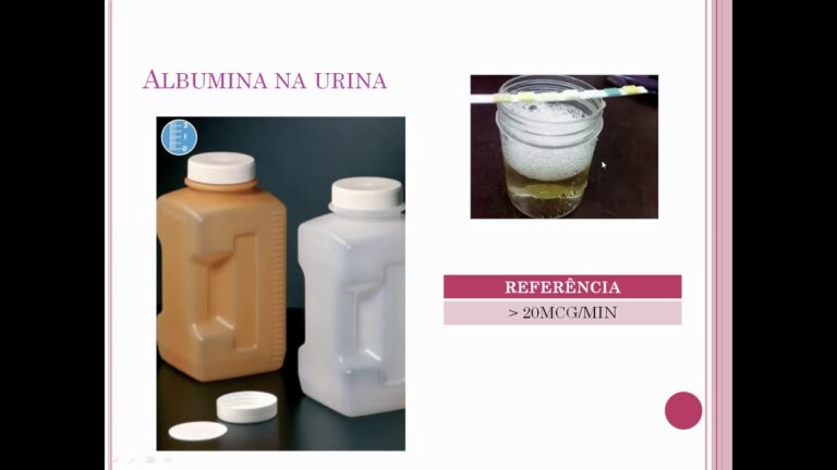 Entendendo o Exame de Albuminúria: Importância e Interpretação