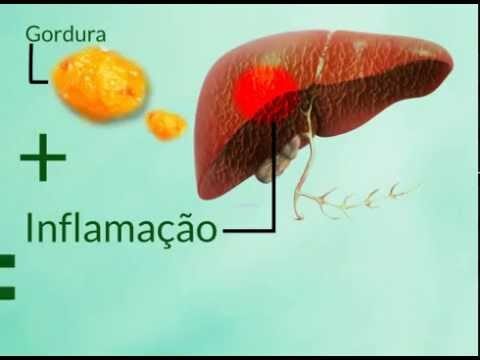 Vinho e Saúde do Fígado: Mitos e Verdades | Actualizado mayo 2026