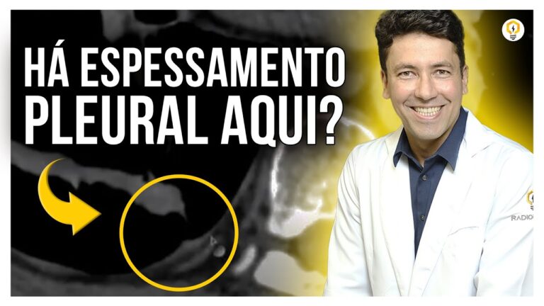 Espessamento Pleural Apical Bilateral: Causas e Implicações Clínicas