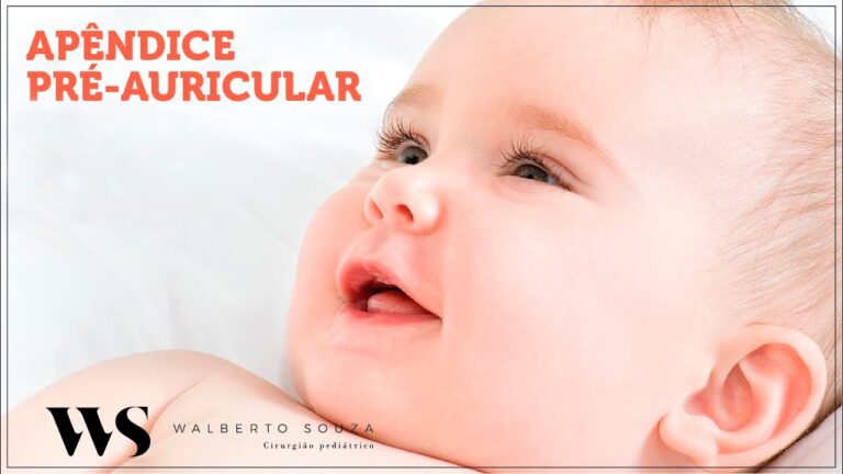 Apêndices Pré Auriculares: Causas e Implicações Médicas