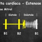 Sintomas do Canal de Dente: Guia Conciso