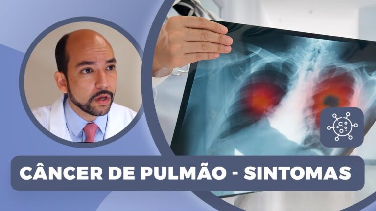 Avanços no Diagnóstico e Tratamento do Cid Ca de Pulmão