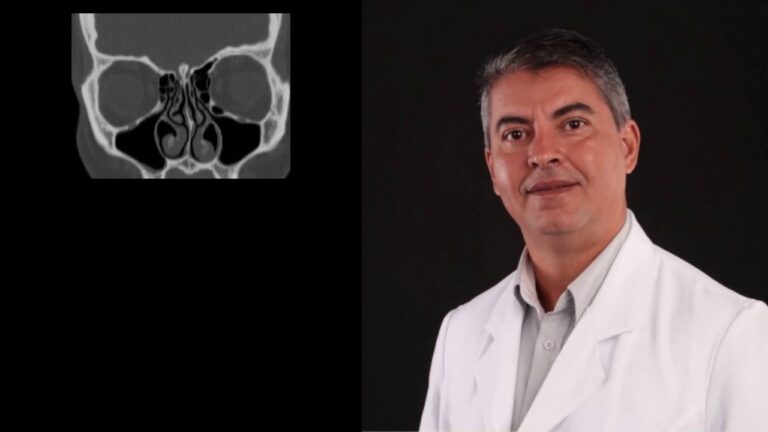 Células de Haller: Funções e Importância na Biologia Celular