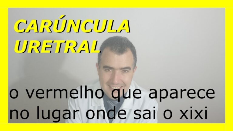 Carúncula Uretral Feminina: Funções e Importância na Saúde da Mulher
