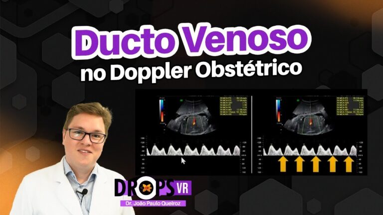 Ducto Venoso: Impacto da Onda Negativa na Circulação Fetal
