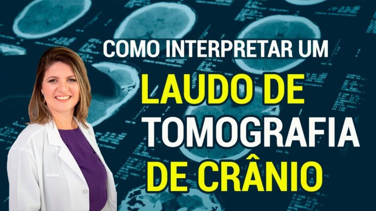 Avan&ccedil;os na Hipoatenuante em Tomografia de Cr&acirc;nio